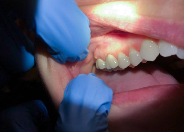 Best Emergency Dental Surgery in Savoy, IL